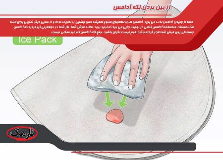 از بین بردن لکه آدامس